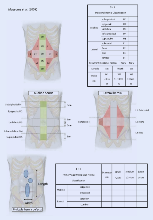 EHS hernia classification – Muysoms et al. (2009)